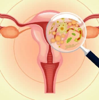 💖 Bacterial Vaginosis (BV): Symptoms, Causes, Diagnosis, And Treatment
