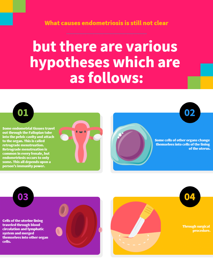 infographic Causes of endometriosis