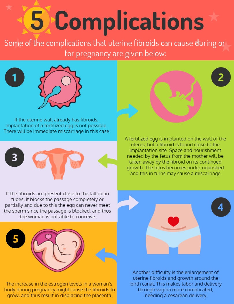 Complications of uterine fibroids