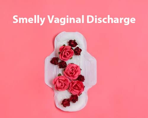 Smelly Vaginal Discharge