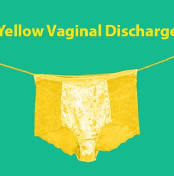 💖 Yellow Vaginal Discharge: Types, Symptoms, Causes