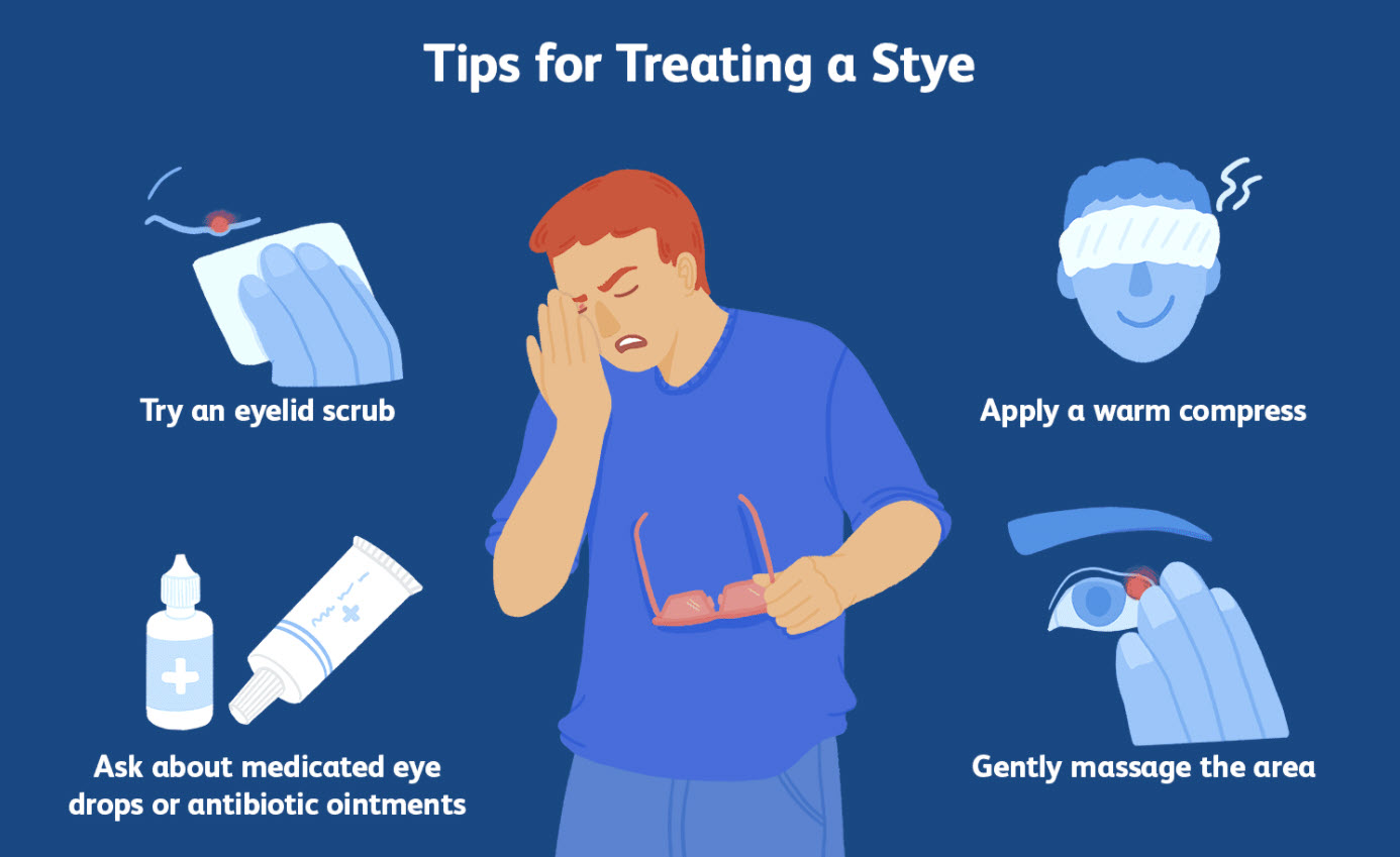 Eye stye treatment