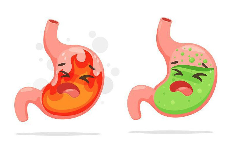 What causes acid reflux