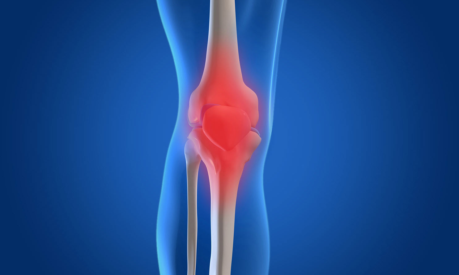 What is osteoarthritis