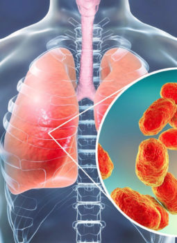 💖 Pneumonia: Types, Causes, Symptoms, Diagnosis and Treatment