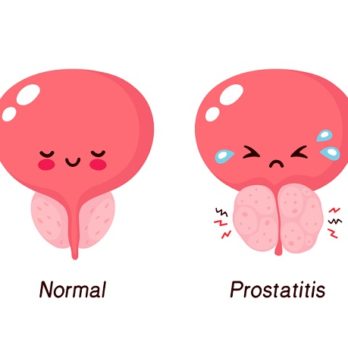 💖 How Prostatitis Is Diagnosed? Prostatitis: Types, Symptoms, and More