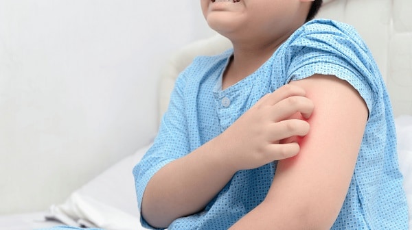 What are the symptoms of Lyme disease in a child